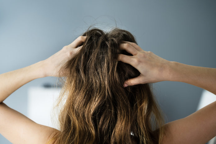 Itching Dry Head Scalp