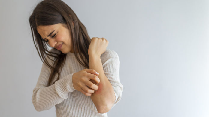 Dermatitis
