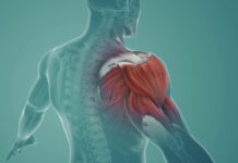 Ease Muscle Soreness Naturally: Top 10 Proven Remedies for Quick Relief and Recovery