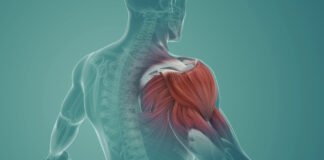 Ease Muscle Soreness Naturally: Top 10 Proven Remedies for Quick Relief and Recovery
